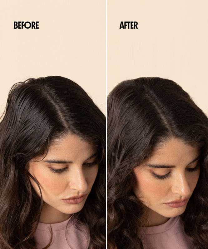 Dry Shampoo